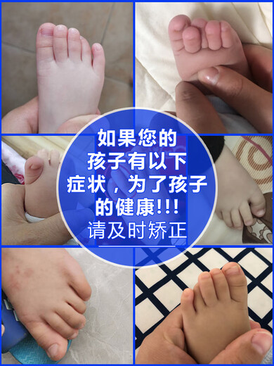 脚趾分离器婴儿童脚趾头小孩大拇指外翻矫正器宝宝重叠分离器分趾大母指内扣矫正 829儿童5趾重叠舒适款6-12岁蓝色一双装 均码