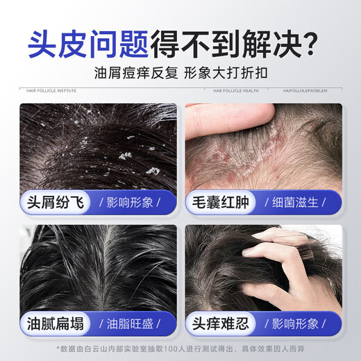 Baiyunshan Selenium Disulfid Shampoo Anti-Dandruff Anti-Chon-Kontrollölflausch und erfrischende silikonfreie Shampoo-Männer und Frauen 400 ml