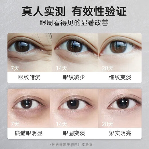 Kasugai Fuyan Anti-Wrinking Refleing Eye Cream Bolss Levanting Facting Eye Wrinkles Men and Women Fade Fine Lines Rejuvenation Cream Tres paquetes de 20 g [Pack Cycle Pack]