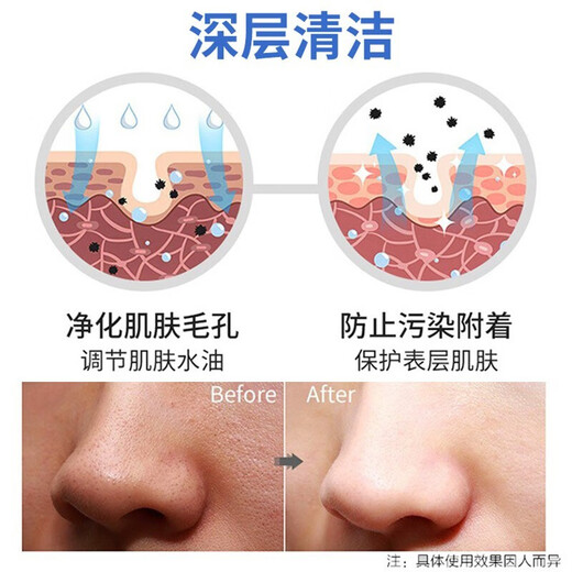 Nanjing Tong Ren Tang Acne Cleansing Milk Men and Women Youth Exfoliating Oil Control Blackhead Pore Shrinking Cleansing Milk 200g Chinese Valentine's Day