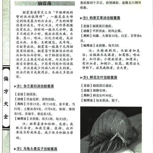 
Genuine Chinese Medicine Prescriptions Page 731 Learning Books Chinese Medicine Books Traditional Chinese Medicine Books Prescriptions Formulas Chinese Medicine Self-study Hundred Days of Classics and Classics Newly compiled drug practical manuals Traditional Chinese medicine formulas Magical medicines and folk remedies Da Panjing Yue Quanshu learns to prescribe Chinese medicine prescriptions in 100 days A collection of famous doctors and prescriptions in China Health Collection of folk remedies