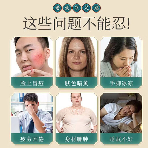 Beijing Tong Ren Tang Old Beijing Mugwort Foot Patch Foot Care Moxibustion Patch Mugwort Leaf Patch Heel Patch Sleep Warming Foot Patch 50 patches in a box