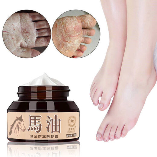 Daimeier Horse Oil for Cracked Hands and Feet, Dry and Peeling Hands and Feet, Cracked Feet, Cracked Heels, Anti-Cracking Cream, Protective Hand and Foot Cream 3 Bottles, Antifreeze + Anti-Drying + Repair + Moisturizing