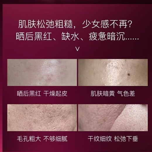 Han Xizhen (HEXZE) Han Xizhen Snow Rose Backlight Skin Secret Whitening and Moisturizing Full Series Official i-Part Set Flagship Skin Care Products Store Snow Rose Water Light Skin Rejuvenation Mask 5 Pieces 1 Box 2