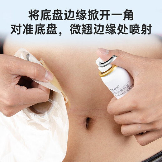 Nurse ClassMate Stoma Care Products Desproteo de spray Spray Chassis Remoción de gel Gel Spray Medical Adhesivo Medical 12010 50 ml (paquete mensual)