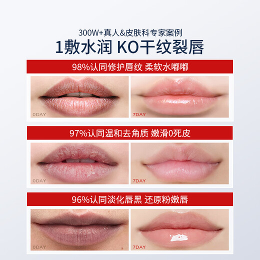 Dr. Watson lip mask lip balm moisturizing, moisturizing and hydrating lips for women, anti-drying and peeling, night repair, diluting lip lines