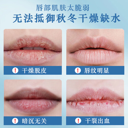 UNIO Provitamin B5 Lip Balm Moisturizing Moisturizing and Hydrating Lip Strip Removes Dead Skin Anti-Crack lip 8g for Men and Women
