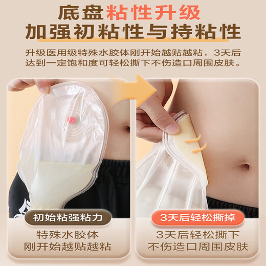 Poche de kefuzao, selles anorectales de qualité une pièce diversion rectal diversion fèles de fèles à poche ouverte 5009-1 Boîte] Modèle de clip de base + 3 clips + coton-collat gratuit, protection