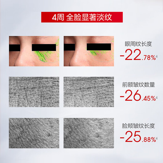 珀莱雅红宝石面膜2.0干皮补水焕亮肌肤紧致淡纹 护肤品生日礼物女男10片