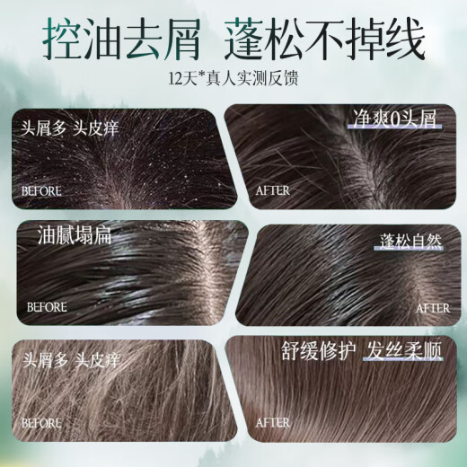 
Korean Grain Oil Control Long-lasting Fluffy Shampoo Shampoo 800ml Anti-dandruff Relieve Itchy and Remaining Scent Men and Women Shampoo Shampoo Shampoo