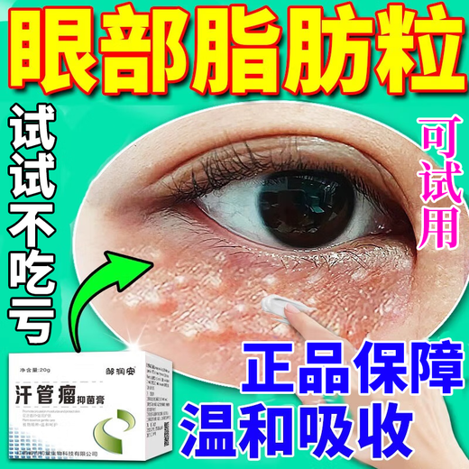 Syringoma removal cream, fat particle removal artifact, grease particle removal, white particle removal around the eyes, special eye cream for men and women, one box