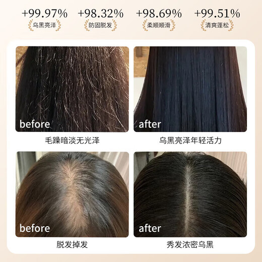 Daiqing Silk Antieletion Shampoo Shampoo Fat Donglai Тот же официальное солидное развитие и рост крем для волос Флагманский антилоговый мужчина и женский магазин 1 бутылка 420 мл [контроль нефти, анти-отрывок, антиталость и пушистость]