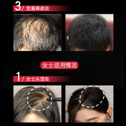 Sumei's (COMOOS) hair fiber powder to modify and style wig powder fiber re-hair artifact to fill bald fluffy powder hairdressing wig powder 25g black + sprayer
