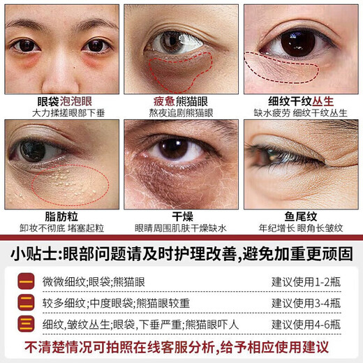 同仁堂类蛇毒眼霜淡化细纹提拉紧致黑眼圈眼袋脂肪粒男女士通用