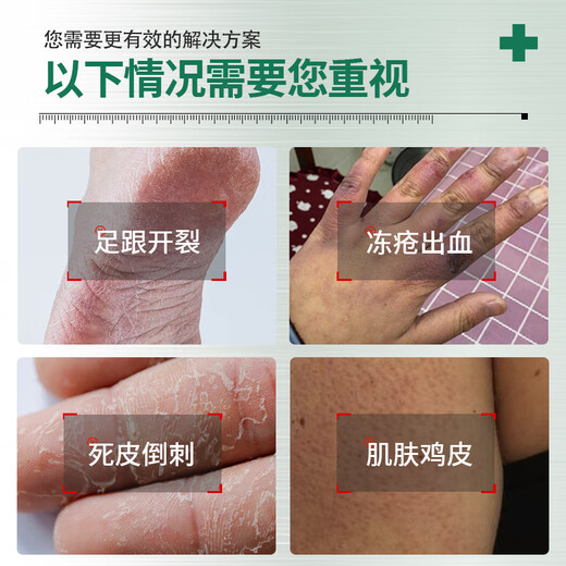 BEAUTY NOTES Horse Oil Anti-Crack Cream Vaseline Cracked Hands, Feet, Cracked Heels, Moisturizing Body Lotion, Hand Cream 380g