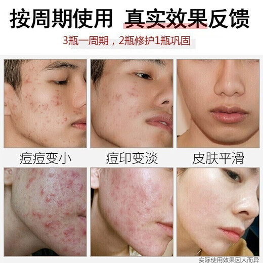 Tongrentang Anti-Acne Facial Cleanser Men's Amino Acid Salicylic Acid Oil Control Removes Mites, Removes Blackheads and Acne Marks and Shrinks Pores 200ml