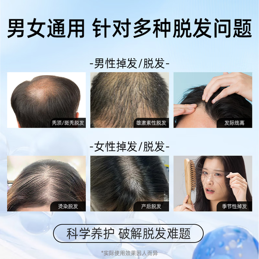 Nebe防脱固发洗发水护养头皮控油去屑蓬松柔顺人参根侧柏叶洗发露男女 【55/瓶 中度脱发适用】洗发水*2