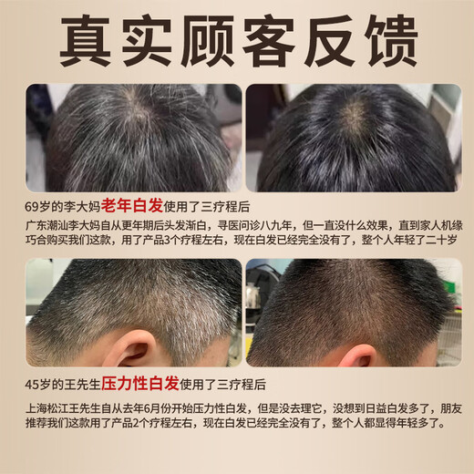 Tongrentang Black Ganoderma Lucidum Heshou Polygonum Multiflorum Shampooing Black Hair Plant naturel Nourishing Hair Roots Care Shine Shampoo 300 ml