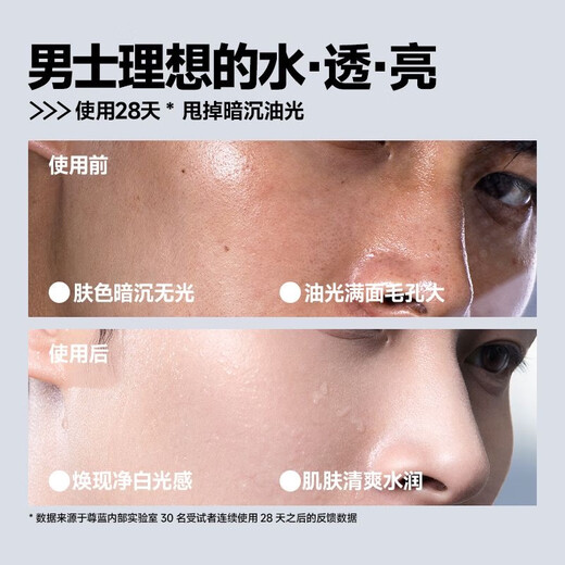 尊蓝男士美白爽肤水补水保湿细毛孔控油提亮清爽润肤护肤品套学生男友 美白爽肤水100ml+美白洁面乳120g