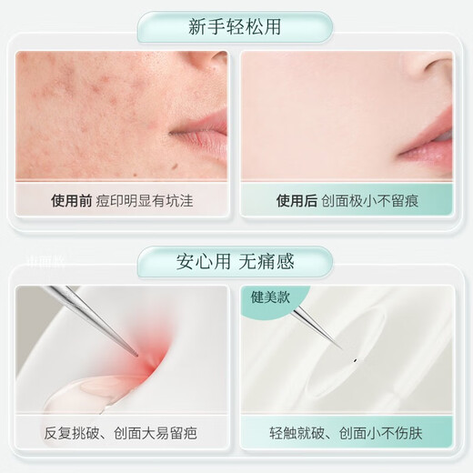 Jianmei Chuangyan Ultra-fine Acne Needle Set Cell Clip Blackhead Removal Tweezers Scraping Closed Mouth Squeezing Acne Removal Needle Cleaning Tool Sharp Mouth + Gold Super Sharp Cell Clip 2 Pieces