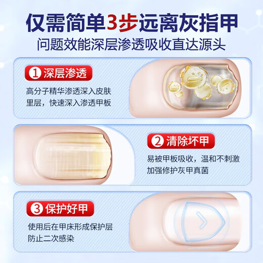 Hong Kong Pharmacy Co., Ltd. special onychomycosis removal, thickening, yellowing and emptying of onychomycosis, suitable for onychomycosis, Chinese herbal water antibacterial solution 30ml