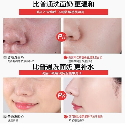 Tongrentang Anti-Acne Facial Cleanser Men's Amino Acid Salicylic Acid Oil Control Removes Mites, Removes Blackheads and Acne Marks and Shrinks Pores 200ml