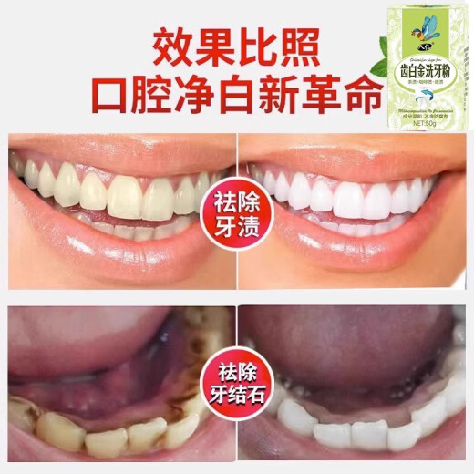 Renren Tooth Cleaning Powder Whitens Teeth and Calculus, Removes Tartar, Tea Stains, Cigarette Stains, Coffee Stains, Bad Breath, Whitens Yellow Teeth, Three Boxes of Teeth Cleaning Powder