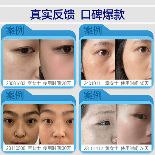奈皙日本377祛斑面膜美白补水淡斑提亮肤色女男士去斑黑色素胖东来