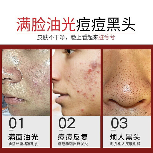 Tongrentang Anti-Acne Facial Cleanser Men's Amino Acid Salicylic Acid Oil Control Removes Mites, Removes Blackheads and Acne Marks and Shrinks Pores 200ml