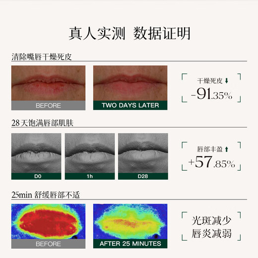 Treesymbol进口唇膜组合唇部精华保湿滋润补水修复去死皮淡化唇纹润唇膏男女 【昼夜24h奢养】唇部精华16g