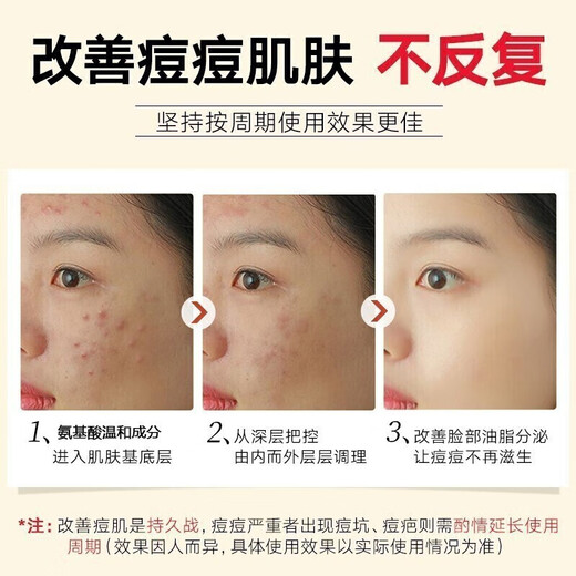 Tongrentang Anti-Acne Facial Cleanser Men's Amino Acid Salicylic Acid Oil Control Removes Mites, Removes Blackheads and Acne Marks and Shrinks Pores 200ml