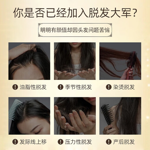 南京同仁堂防脱育发洗发水生姜头发增防脱发控油蓬松草本老姜王固发养发508g