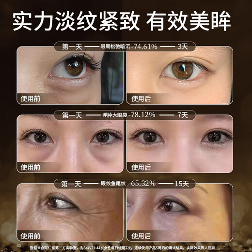 Tongrentang Eye Cream quita bolsas para los ojos, círculos oscuros, ilumina líneas finas, eleva, tensa, anti-arrebre, 50g universal para hombres y mujeres