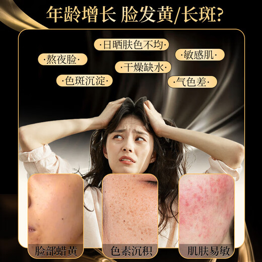 Peking Tongrentang Sommersprosse-Entfernungscreme Nr. 1 Starkes Aufhellung und Aufhellen des älteren gelben, bräunten, sonnengetrockneten Sommersprossen Melanin Feuchtes Gesicht echtem Astragalus für Männer und Frauen. 1 Flasche wird empfohlen, um 50 g gemäß dem Behandlungsverlauf zu verwenden