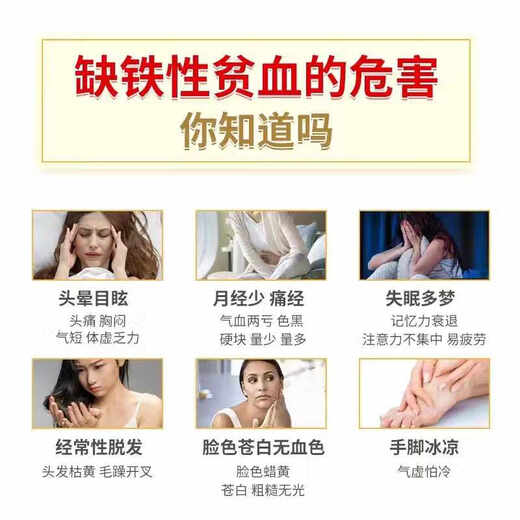 Peking Tongrentang Angelica astragalus Eisen -Tabletten verbessern die Eisenmangel -Anämie Frauen mit sowohl Qi als auch Blut können mit oraler Flüssigkeit kombiniert werden. 1 Flasche [Blue Cap -Zertifizierung] Gesundheitsfunktion Verbesserung der Anämie