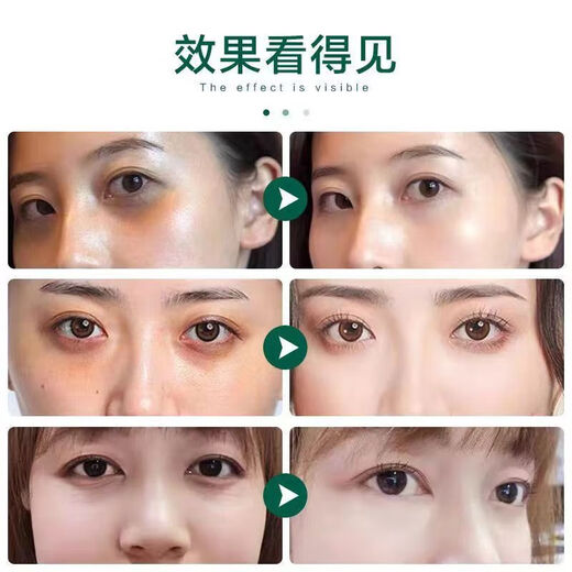 香港大药房眼袋贴去眼袋消除重度眼袋中老年专用去除神器男女士专用眼霜进口 三盒【眼袋+黑眼圈秒除】98%选择