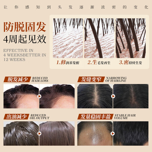 Daiqing Silk Antieletion Shampoo Shampoo Fat Donglai Тот же официальное солидное развитие и рост крем для волос Флагманский антилоговый мужчина и женский магазин 1 бутылка 420 мл [контроль нефти, анти-отрывок, антиталость и пушистость]