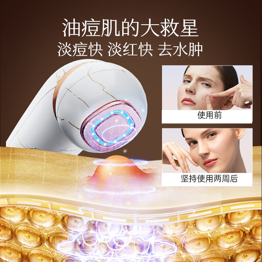 MESMOOTH Beauty Instrument Домашний массаж для лица, линии носа, Очищение, Лифтинг, Омоложение лица, Вводный инструмент C1, Мрамор, Белый Рождественский подарок для подруги