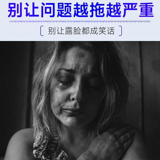 Lark 377 Whitening and Freckle Removal Cream Freckle Removal Whitening and Lightening Melanin Remove Freckles and Melasma for men and women