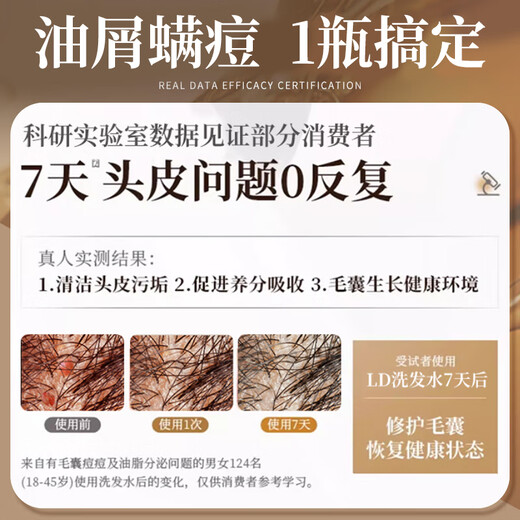 LD Matières premières spéciales importées pour les hommes et les femmes, les follicules pileux, les anti-phares, les démangeaisons, l'inflammation moelleuse à l'huile, le shampooing donglai en graisses propres, une bouteille [Balaying Oil-DandRuff-Dandruff]