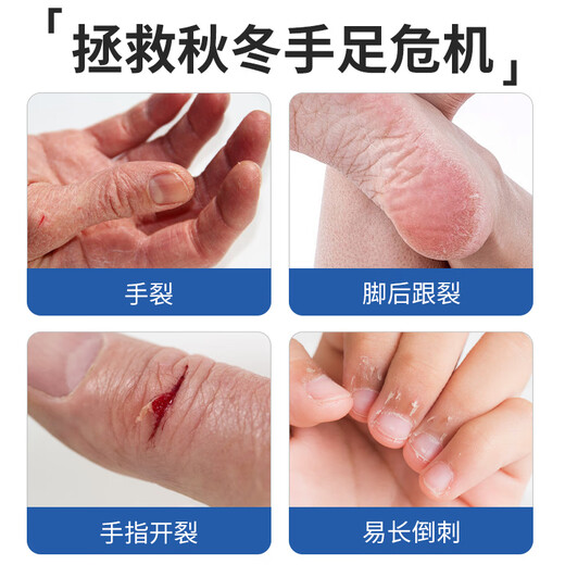 KOOGIS hand and foot Vaseline dry cracked finger and hand cracked patch to protect cracks, non-medical genuine anti-crack tape