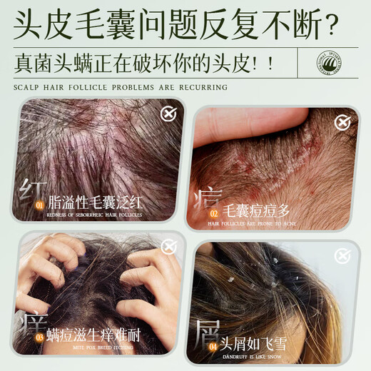 HIEUAILR шампунь для волосяных фолликулов с салициловой кислотой, против перхоти, против зуда, для контроля жирности, пушистый золотой список № 1, шампунь для удаления масла длительного действия