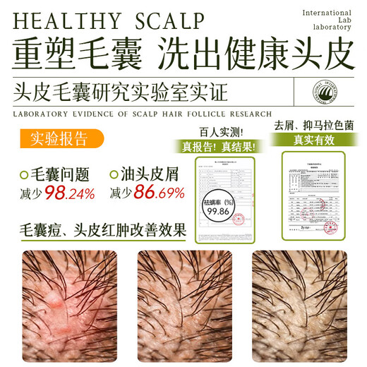 HIEUAILR шампунь для волосяных фолликулов с салициловой кислотой, против перхоти, против зуда, для контроля жирности, пушистый золотой список № 1, шампунь для удаления масла длительного действия