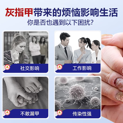 Hong Kong Pharmacy Co., Ltd. special onychomycosis removal, thickening, yellowing and emptying of onychomycosis, suitable for onychomycosis, Chinese herbal water antibacterial solution 30ml