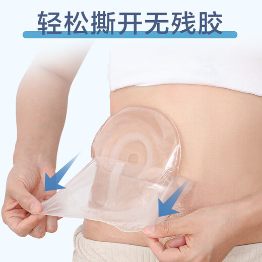 Coloplast Stomia Bath Patch Care Products Protection des plaies après chirurgie Film étanche Natation transparente 2 20 cm * 5m / rouleau + 5009 Poche de stomie * 1 comprimé