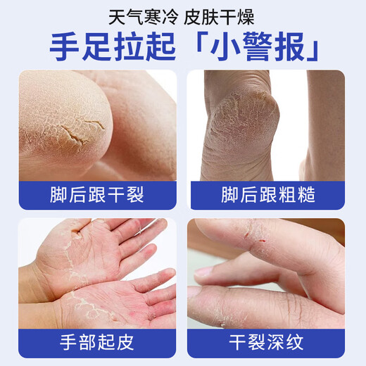 Lishikan Cracked Cream Cracked Heels Hand Cream Prevents Cracked Heels Repairs Cracked Fingers Frost-Cracked Ear Sores Cream