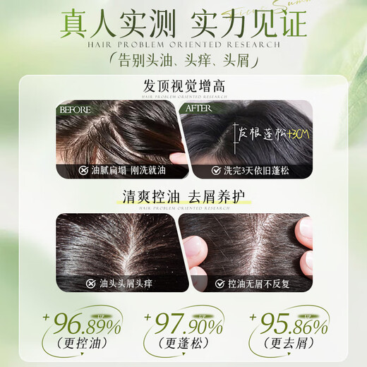 Vetes Aminoácidos Champú y mujeres Anti-Dandruff Anti-Ict Control Aceil duradero Lista de oro de champú sin silicona sin silicona No. 1