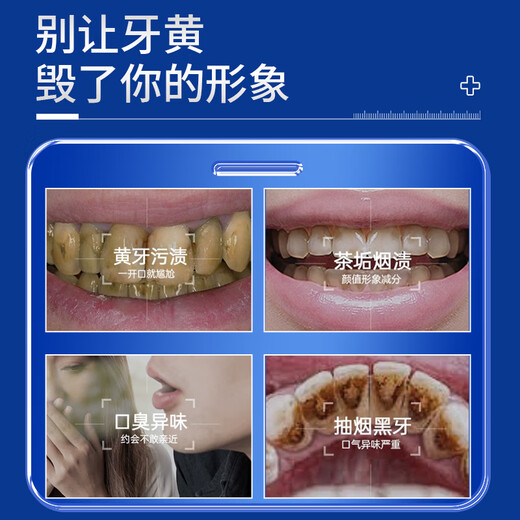 SMILEKIT 炫白牙贴去黄牙齿贴片闪耀美亮白牙贴去烟渍洁白美牙贴便携温和