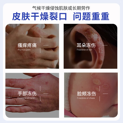 Lishikan Cracked Cream Cracked Heels Hand Cream Prevents Cracked Heels Repairs Cracked Fingers Frost-Cracked Ear Sores Cream