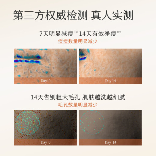 半亩花田金盏花洁面慕斯氨基酸洗面奶清洁控油净痘去黑头男女士送女友礼物